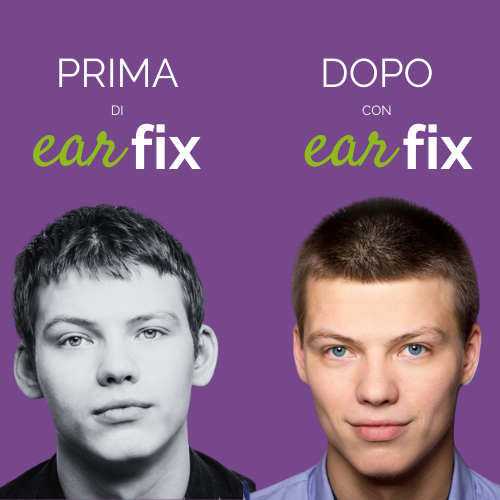 Earfix – Il Correttore per Orecchie per Risultati Naturali - cerotto
